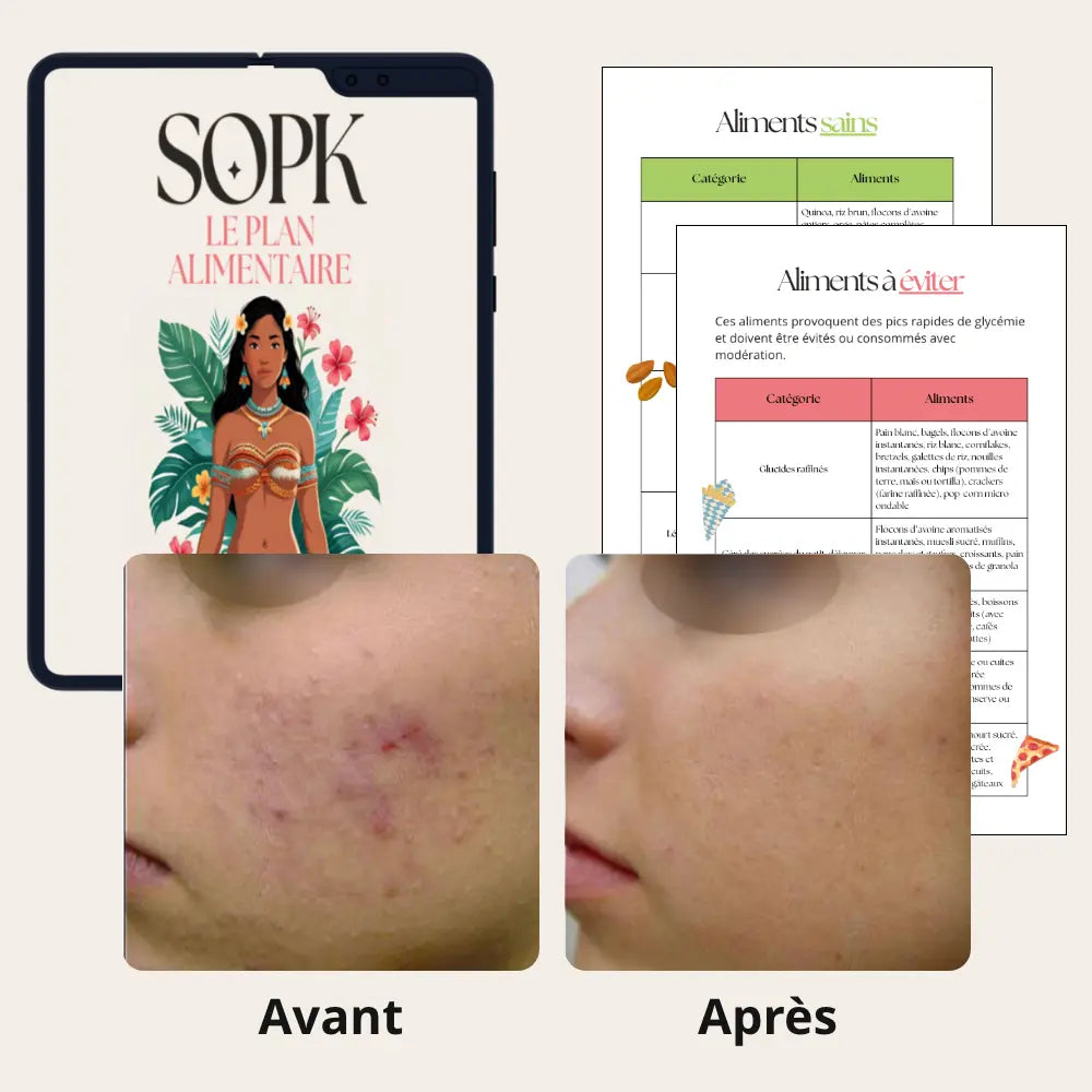 Plan alimentaire SOPK & liste aliments IG bas Madame Patch